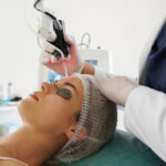 Woman getting a laser skin resurfacing treatment